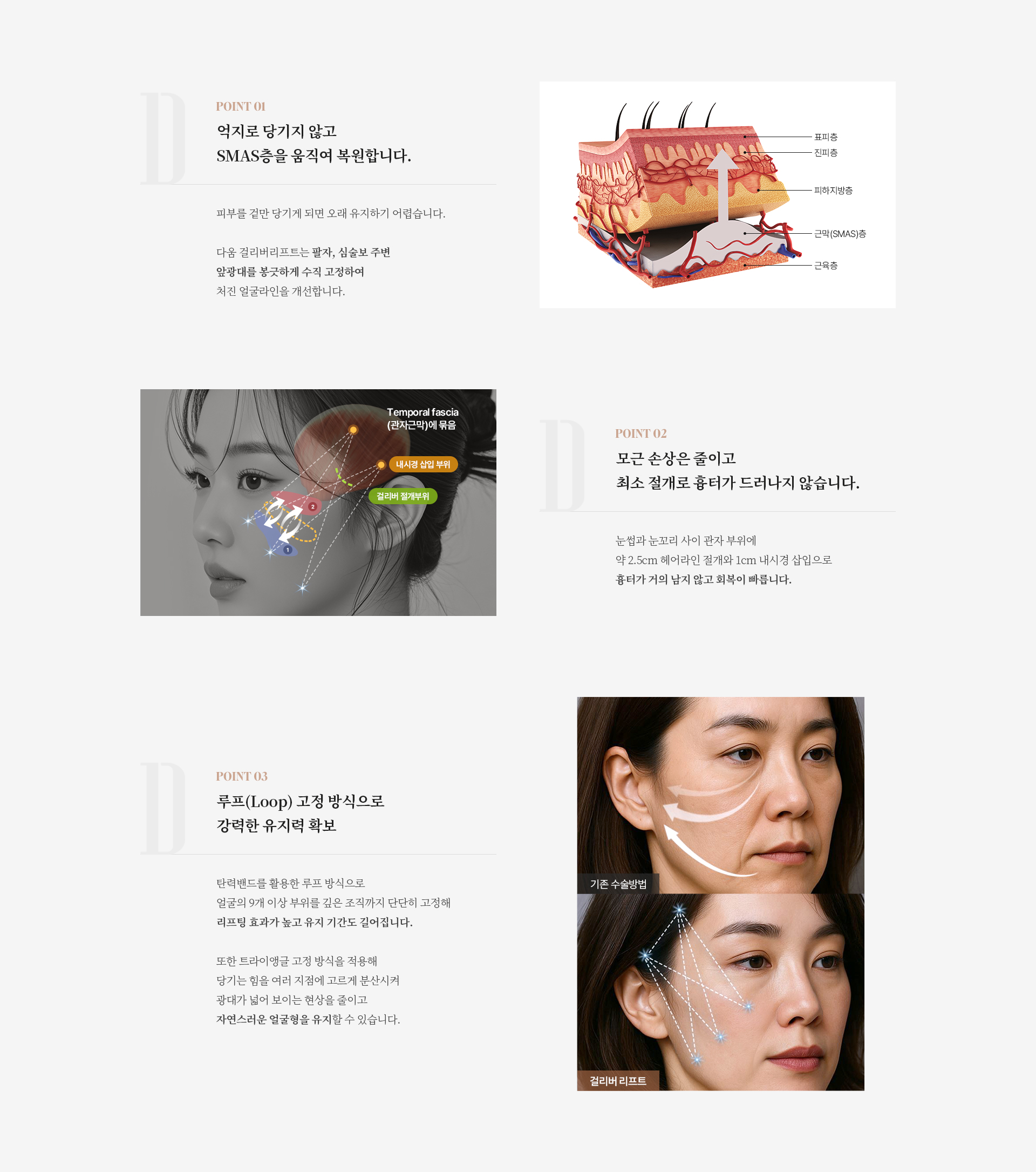 걸리버리프트 상세01