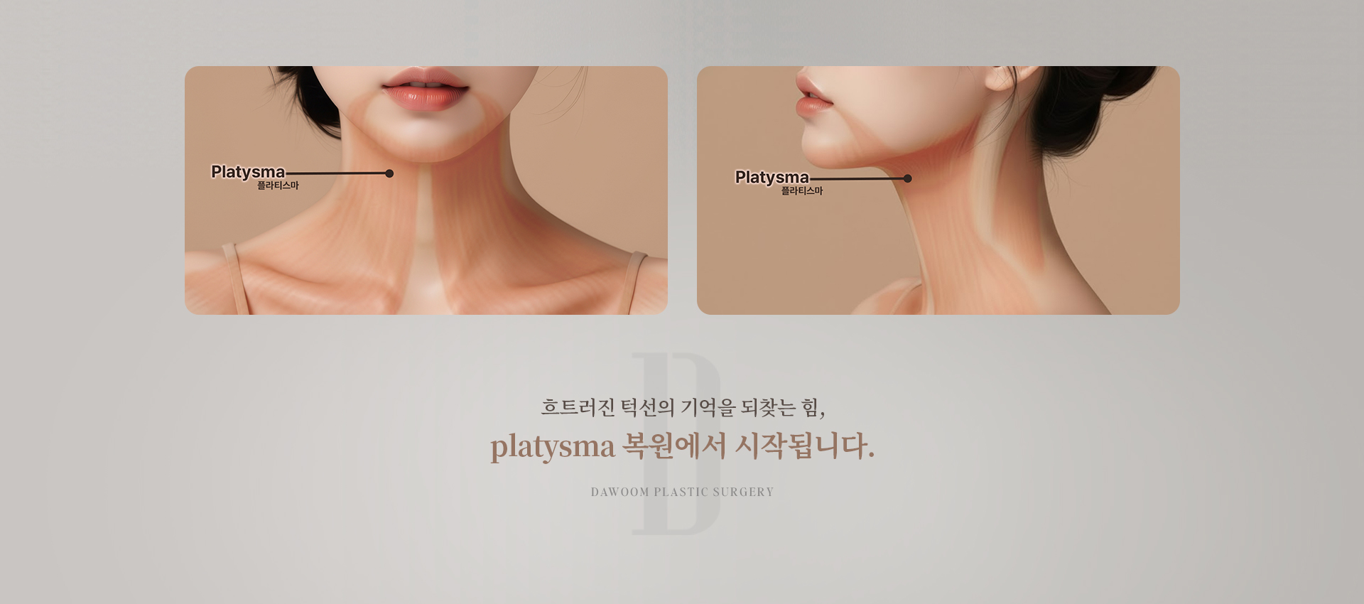 브이리프트 상세04