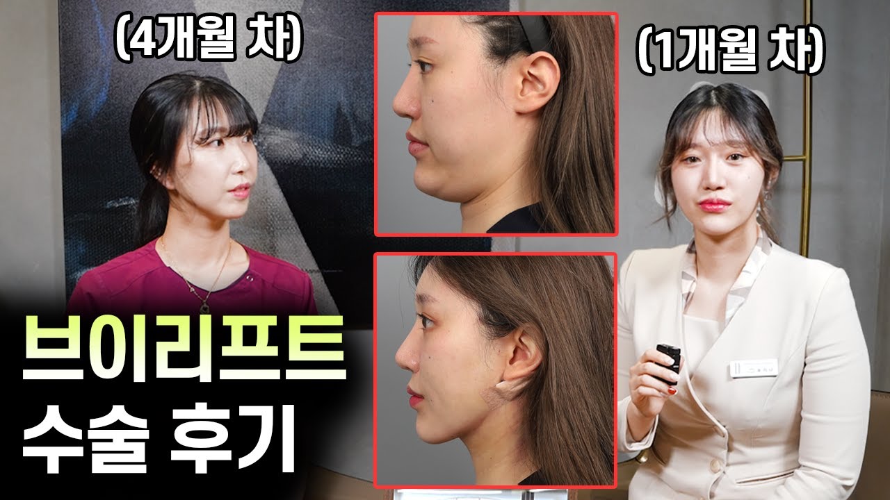 병원 직원이 직접 받아본 수술 후기! 고민이던 이중턱, 긴 중안부는 해결 됐을까?