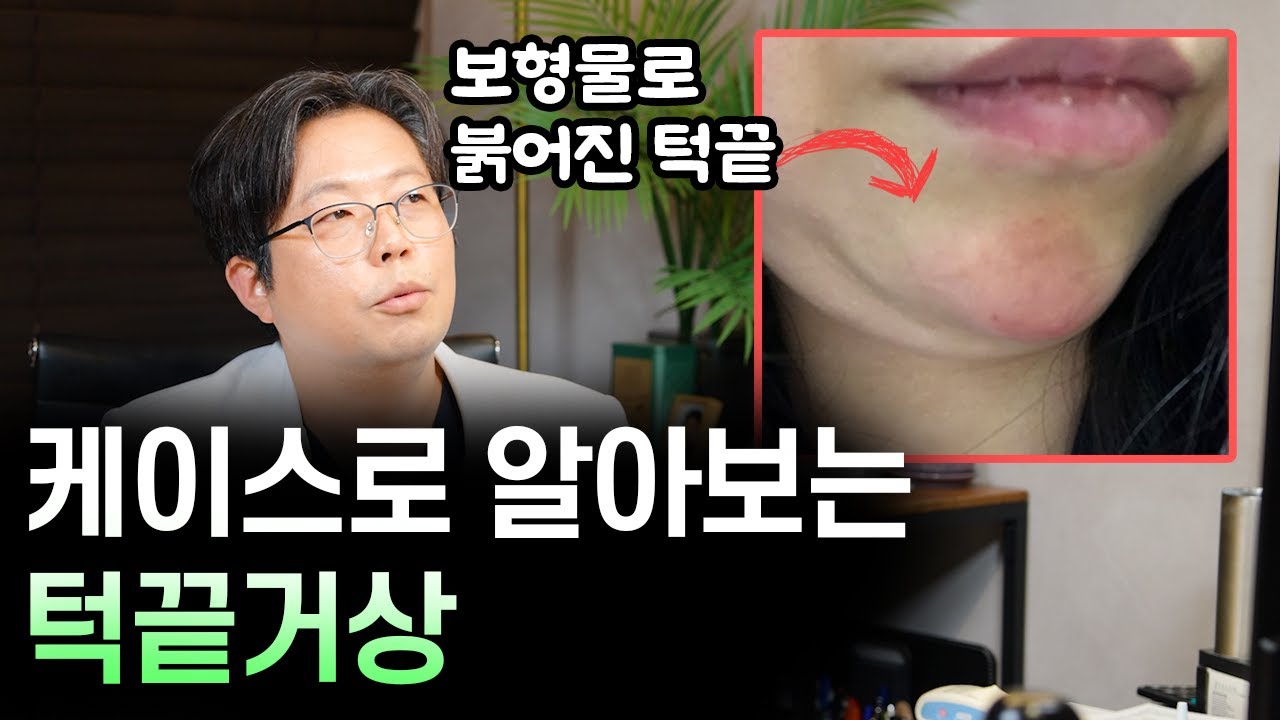 자꾸만 처지고 붉어지는 턱끝, 꼭 해결해야 하는 이유
