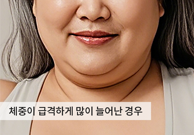케이스1