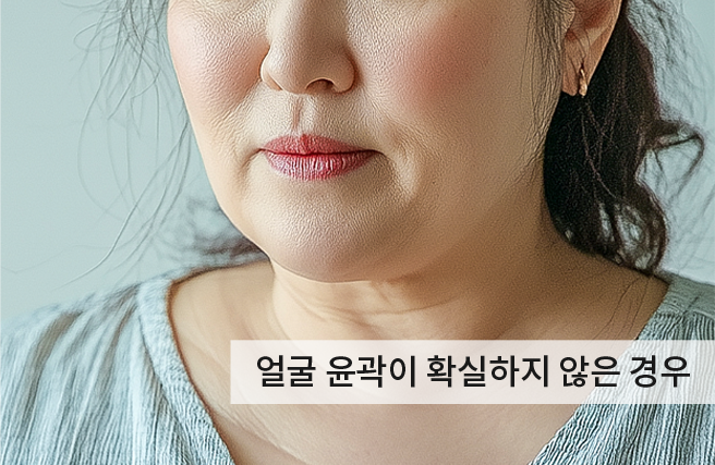 케이스2