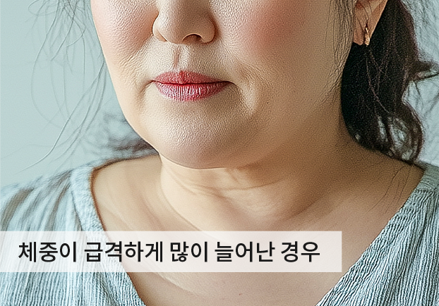 케이스1
