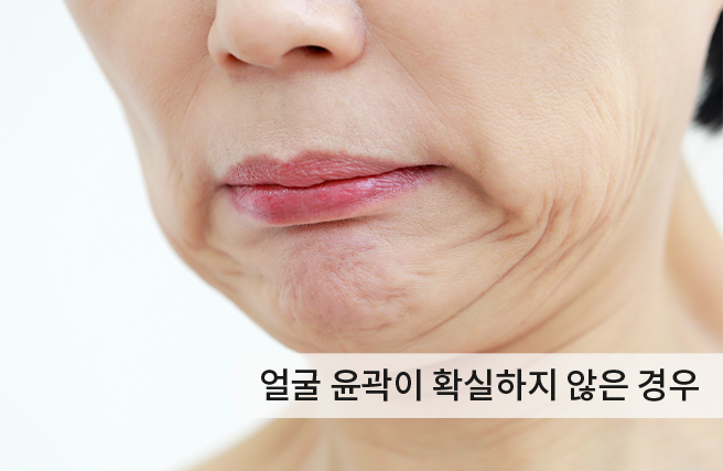 케이스2