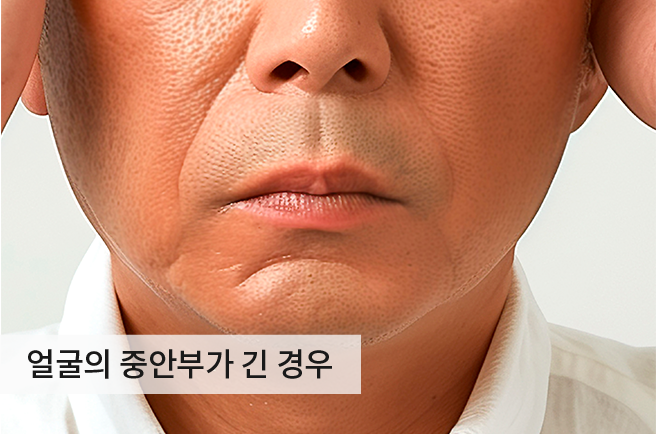 케이스2