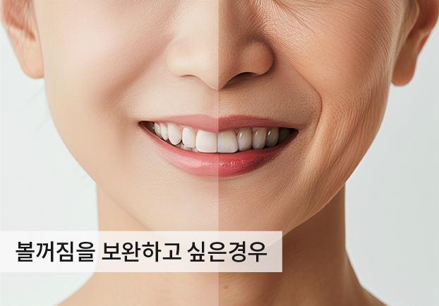 케이스1