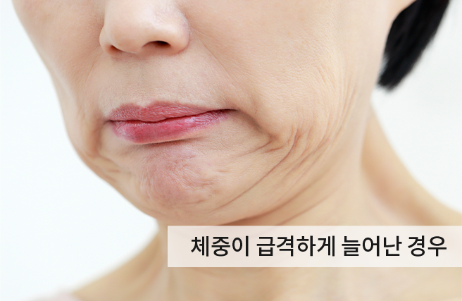 케이스2