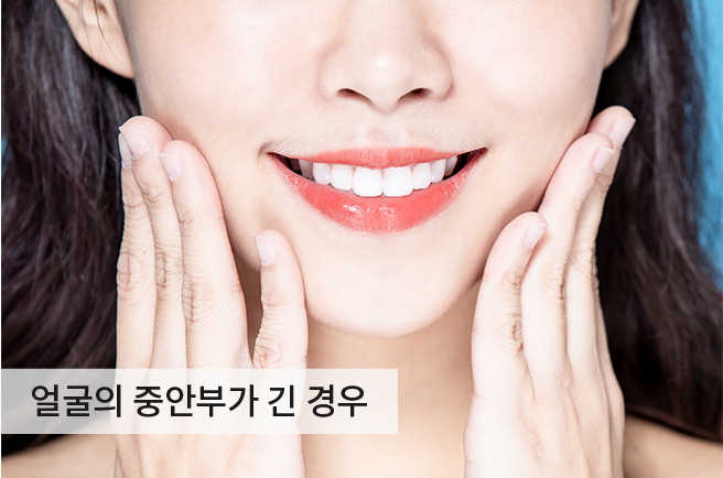 케이스2