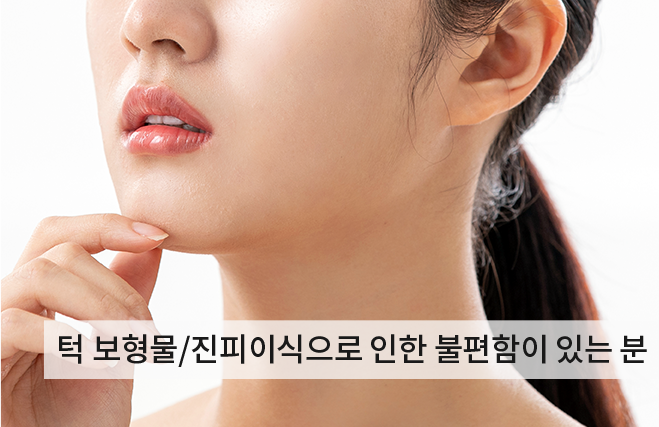 턱끝거상술