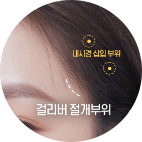 걸리버리프트