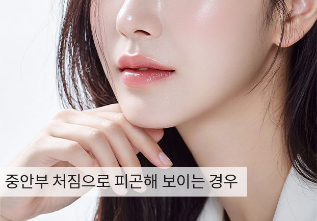 케이스1