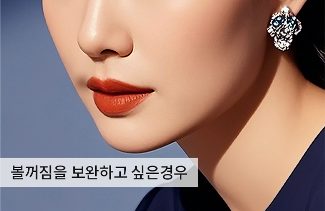 케이스1