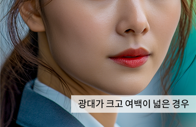 케이스2