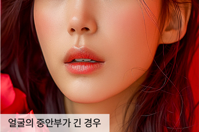 케이스2