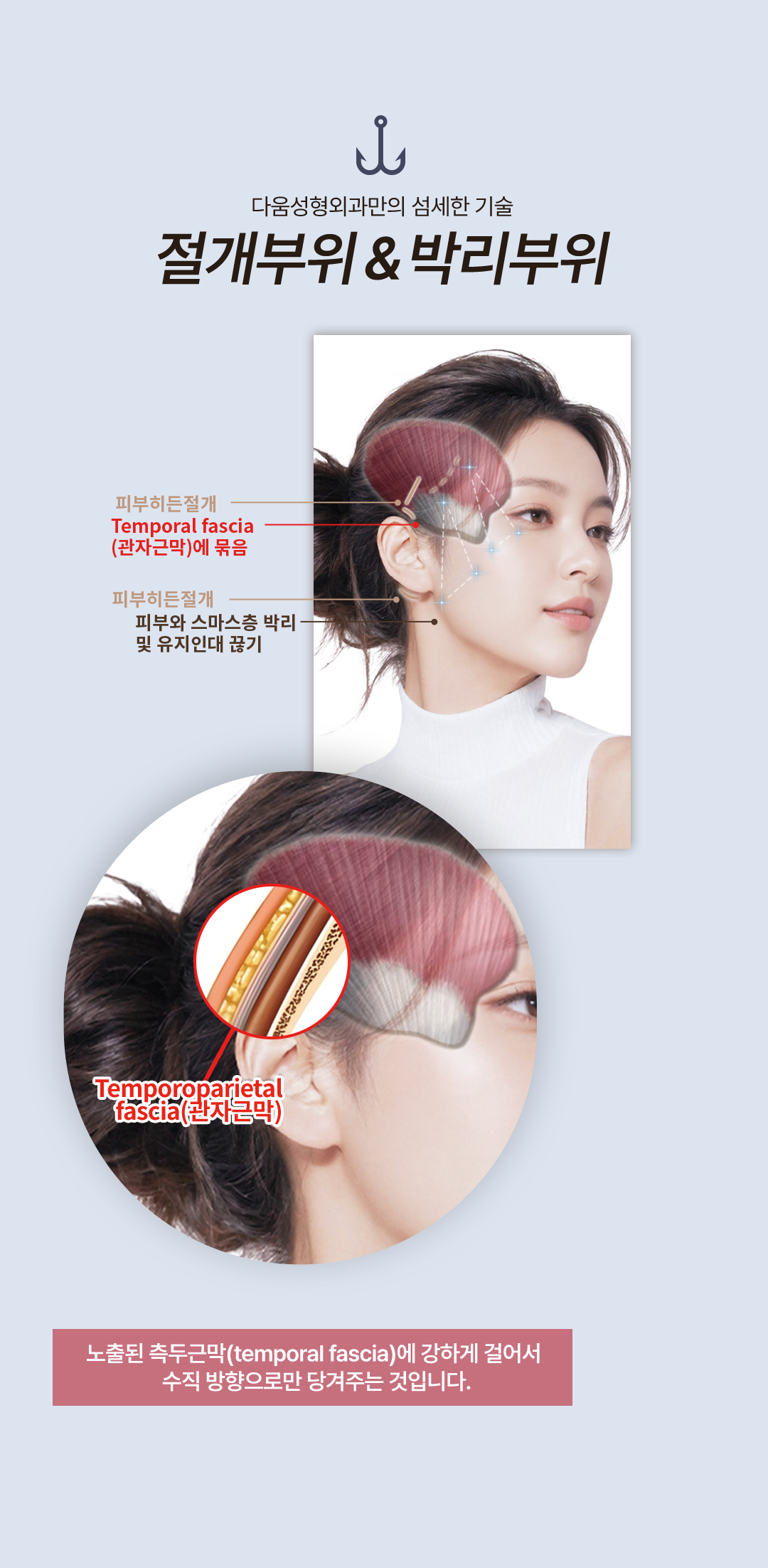 걸리버 리프팅