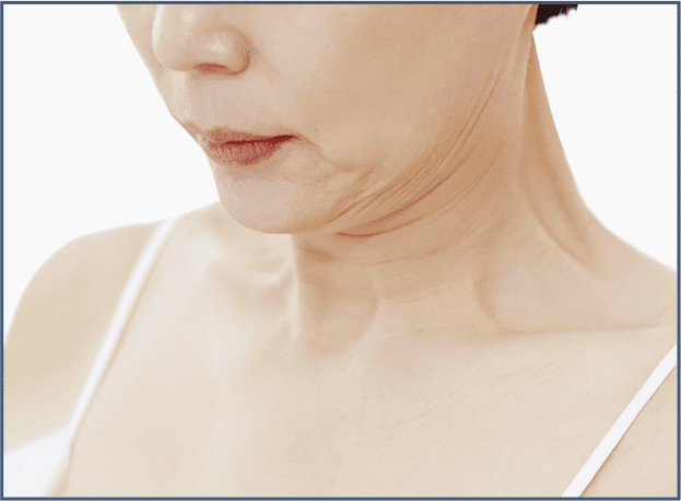 4050 퀵팅리프팅