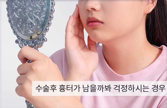 케이스2