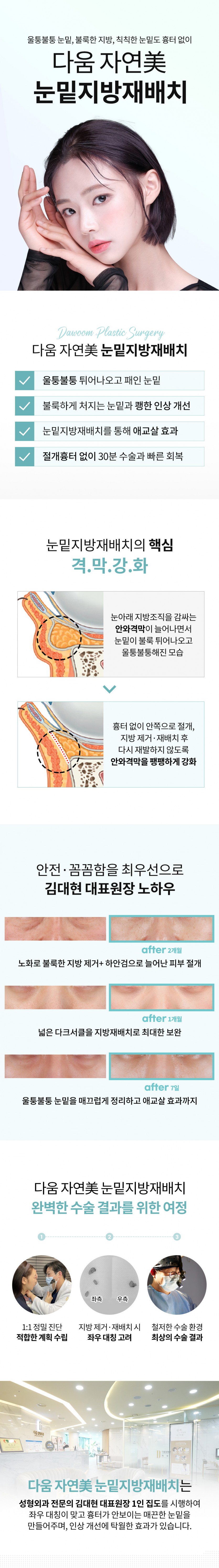 eye2.jpg